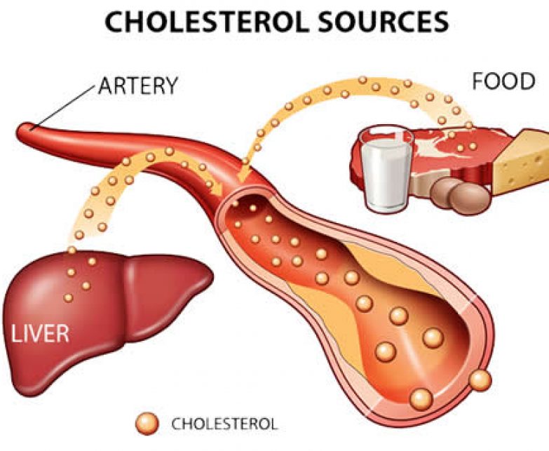 Apa Itu Kolesterol?